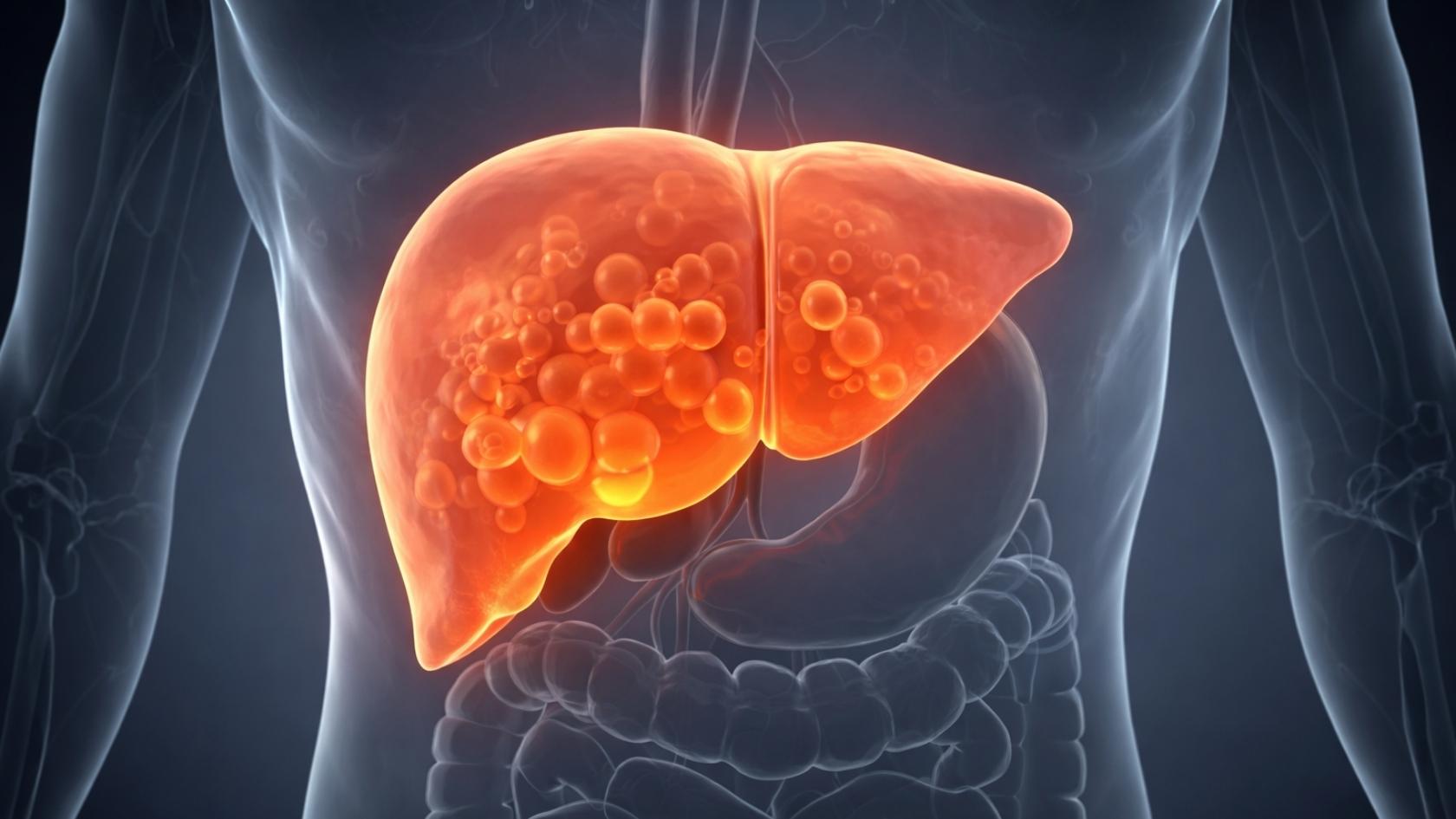 Lipid imbalance and fatty liver develop