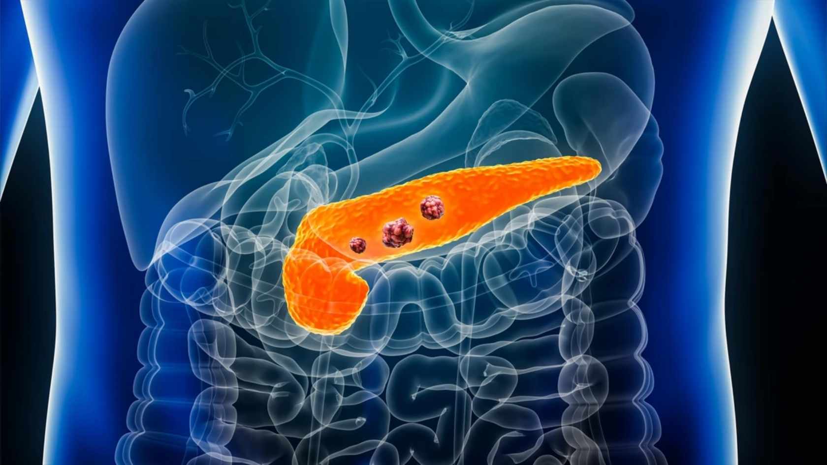 Pancreatic stress increases over time